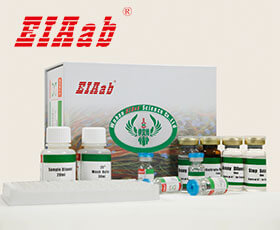 Human ACTH CLIA Kit