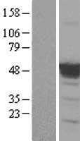 p53(TP53) (NM_000546) Human Tagged ORF Clone