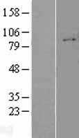 Integrin beta 1(ITGB1) (NM_002211) Human Tagged ORF Clone