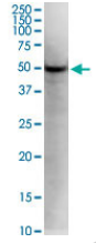 Human KLF5 Monoclonal Antibody