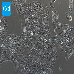 NCI-H441 人肺腺癌细胞（暂不提供）