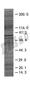 FLT1 293T Cell Transient Overexpression Lysate(Denatured)